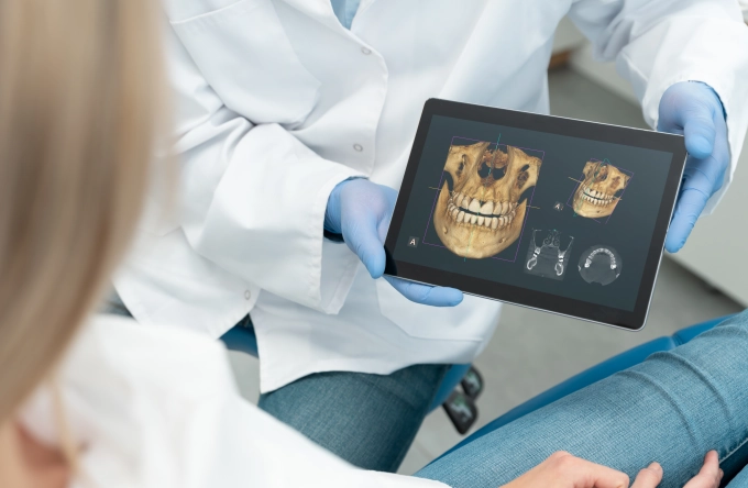 CBCT